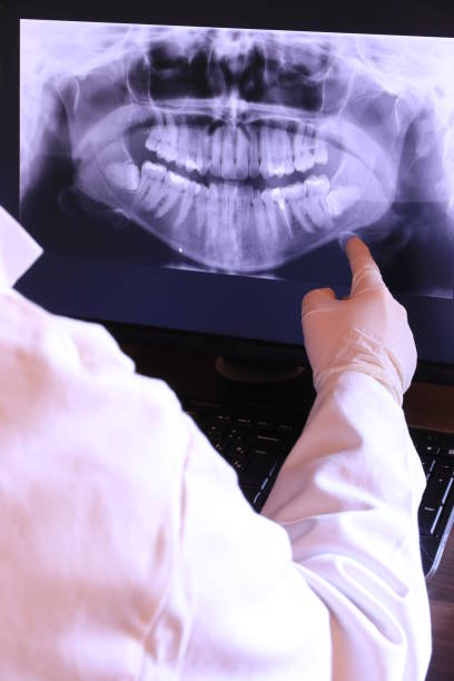 Best Emergency Root Canal Therapy in Summerville, GA