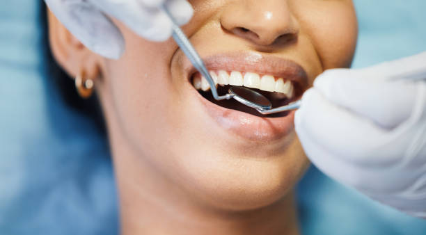 Best Dental Abscess Treatment in Summerville, GA
