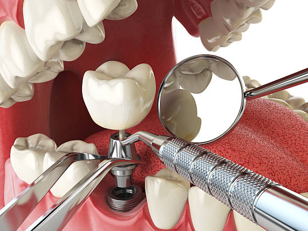 Best Emergency Cosmetic Dentistry (e.g., broken veneers) in Summerville, GA